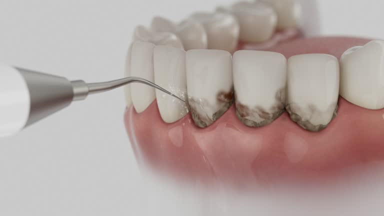 Reliable Dental Implants contractor in French Valley, CA by Smile Center Dentistry